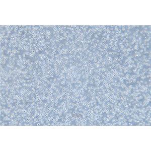 人骨髓增生异常综合征细胞MUTZ-1