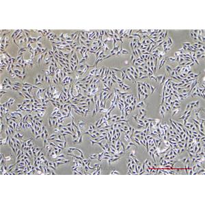 人黑色素瘤细胞A875