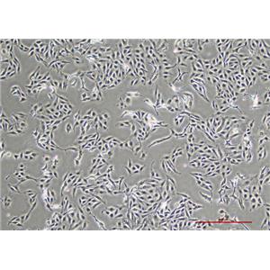 人黑色素瘤细胞A875