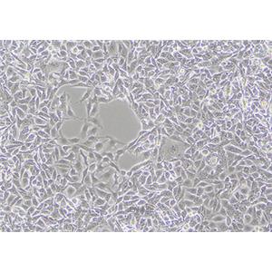 人黑色素瘤细胞MNT-1