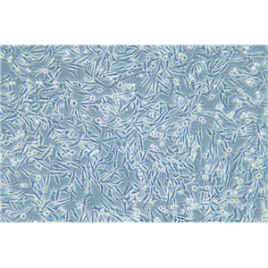 人黑素瘤细胞WM-115