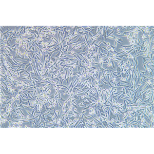 人黑素瘤细胞WM-115