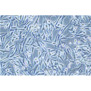 人黑素瘤细胞WM-115