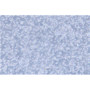 人红白细胞白血病细胞HEL