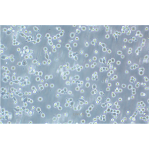 人红白细胞白血病细胞HEL