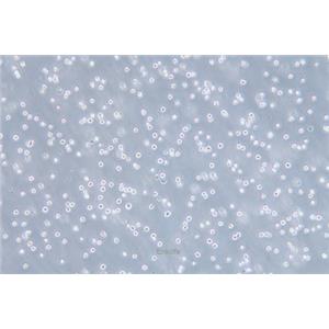 人红白血病细胞Kasumi-1