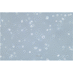 人喉癌细胞TU138