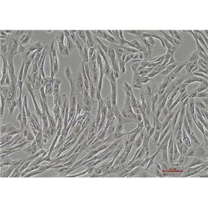 人滑膜肉瘤细胞SW982(STR鉴定) | EnkiLife恩玑生命