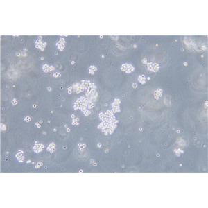 人急性髓系白血病细胞SKNO-1(STR鉴定) | EnkiLife恩玑生命