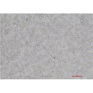 人急性早幼粒白血病细胞NB4