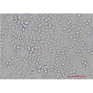 人急性早幼粒白血病细胞NB4