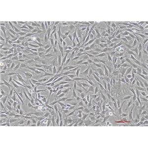 人甲状腺鳞癌细胞SW579(STR鉴定) | EnkiLife恩玑生命