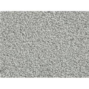 人间变性大细胞淋巴瘤细胞Karpas-299