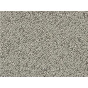 人间变性大细胞淋巴瘤细胞Karpas-299