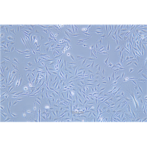 人胶质瘤细胞稳定表达荧光素酶LN-229+LUC