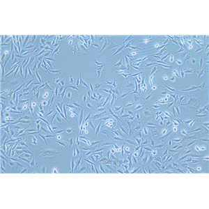 人胶质瘤细胞稳定表达荧光素酶LN-229+LUC