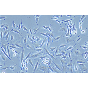 人胶质瘤细胞稳定表达荧光素酶LN-229+LUC