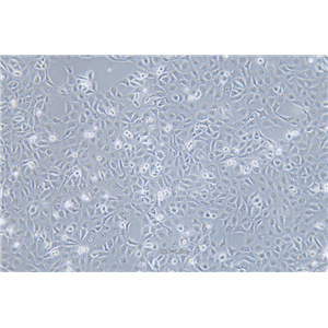 人角膜上皮细胞HCE-T