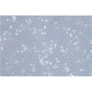 人角膜上皮细胞HCE-T