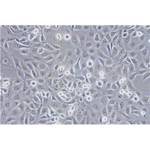 人角膜上皮细胞HCE-T