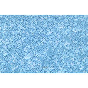 人结肠癌细胞HCT-15(STR鉴定) | EnkiLife恩玑生命