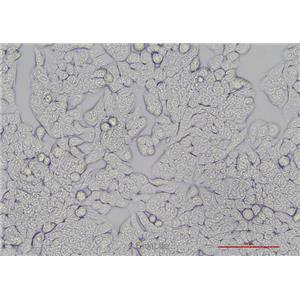 人结肠癌细胞HT-29