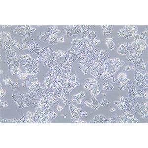 人结肠腺癌细胞LS1034(STR鉴定) | EnkiLife恩玑生命