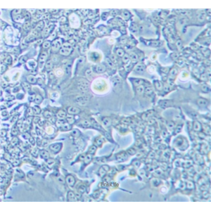 人结肠腺癌细胞SNU-81（STR鉴定） | EnkiLife恩玑生命