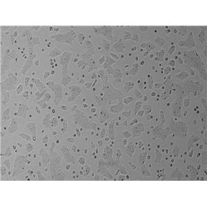 人结肠腺癌细胞SW1116