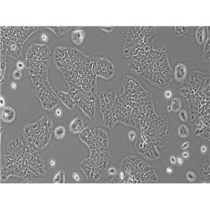 人结肠腺癌细胞SW1116