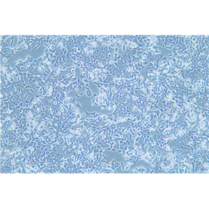 人结直肠癌细胞/氟尿嘧啶耐药株LOVO/5-FU