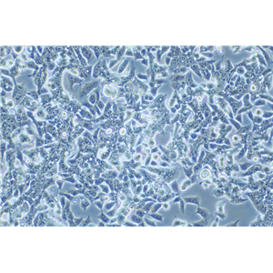 人结直肠癌细胞/氟尿嘧啶耐药株LOVO/5-FU