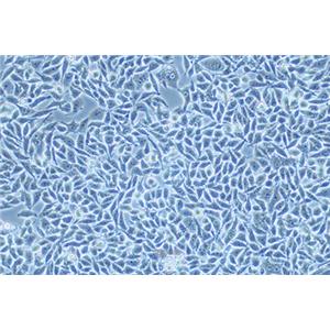 人结直肠癌细胞P53R