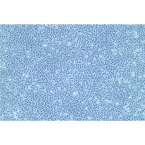 人结直肠癌细胞P53R