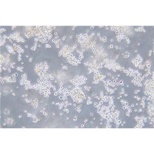 人结直肠腺癌细胞COLO320(STR鉴定) | EnkiLife恩玑生命