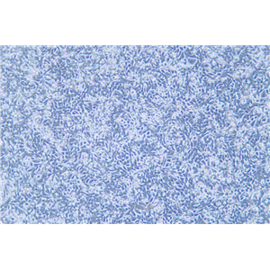 人结直肠腺癌细胞荧光素酶标记SW620-LUC