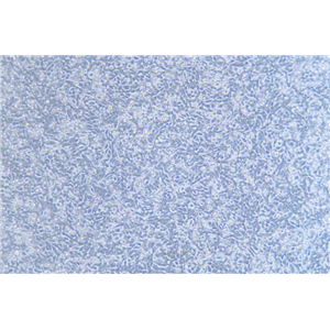 人结直肠腺癌细胞荧光素酶标记SW620-LUC