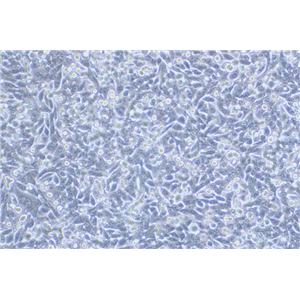 人结直肠腺癌细胞荧光素酶标记SW620-LUC