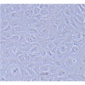 人晶体上皮细胞SRA01/04