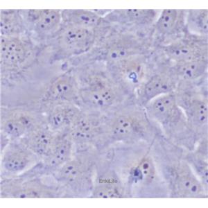 人晶体上皮细胞SRA01/04