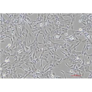 人晶状体上皮细胞HLE-B3