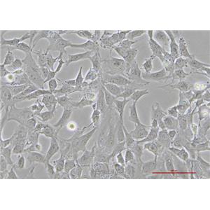 人晶状体上皮细胞HLE-B3