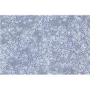 人口腔表皮癌细胞KB(STR鉴定) | EnkiLife恩玑生命