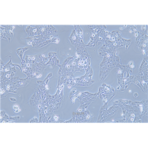 人口腔鳞状癌细胞WSU-HN30(STR鉴定) | EnkiLife恩玑生命