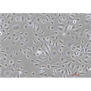 人口腔鳞状肿瘤细胞HSC-2(STR鉴定) | EnkiLife恩玑生命