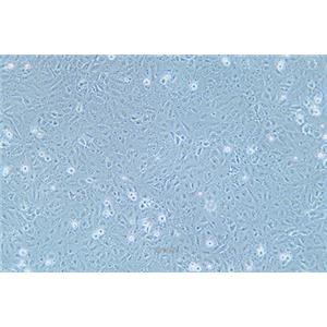 人卵巢癌腺癌细胞OVCAR-8(STR鉴定) | EnkiLife恩玑生命