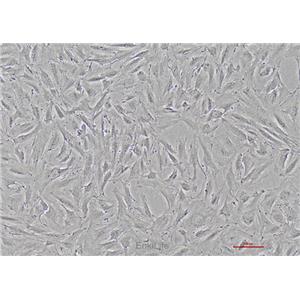 人卵巢颗粒细胞瘤细胞KGN