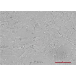 人卵巢颗粒细胞瘤细胞KGN