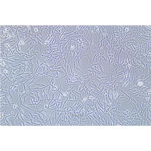 人卵巢透明细胞癌细胞ES-2