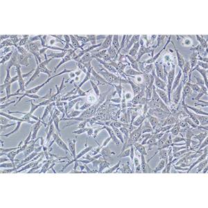 人卵巢透明细胞癌细胞ES-2